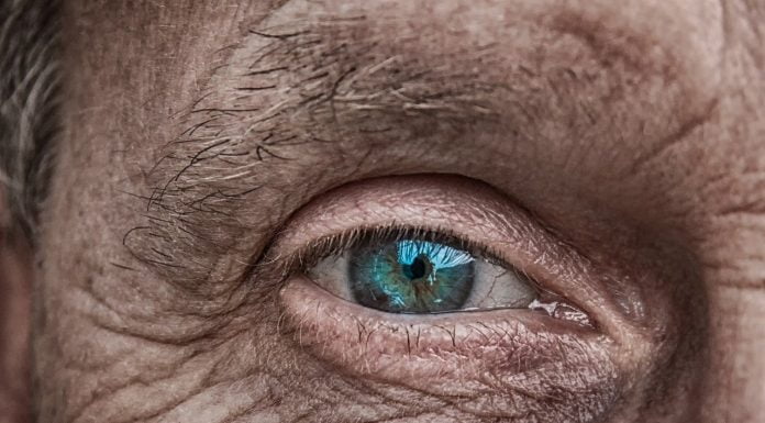 Interpretare vis in care apar riduri