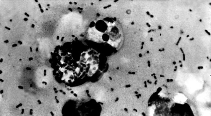 Interpretare vis in care apare ciuma