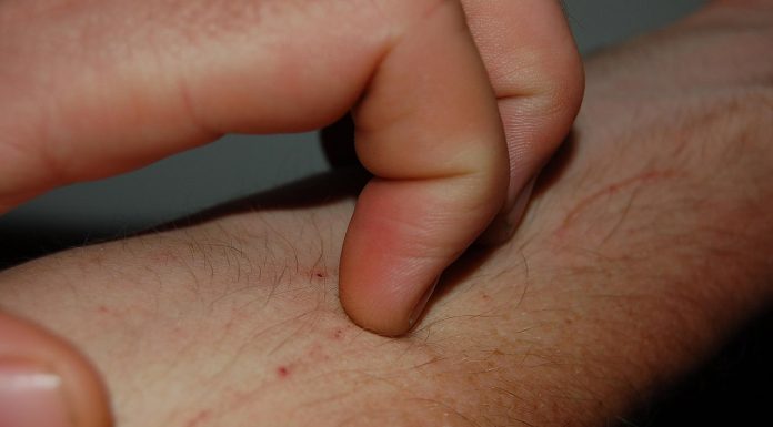 Interpretare vis in care apare mancarime