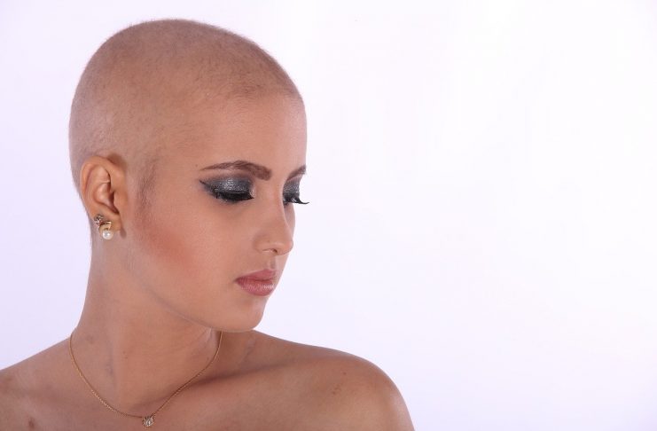 Interpretare vis in care apare o cheala