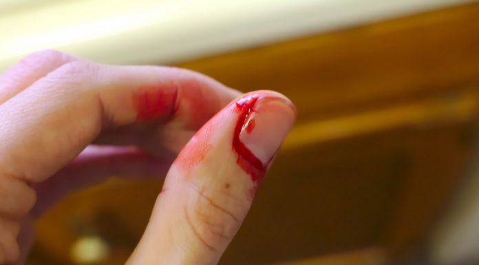 Interpretare vis in care apare o hemoragie