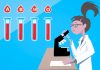 Interpretare vis în care apare o hepatită Interpretare vis in care apare o hepatita