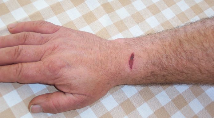 Interpretare vis in care apare o rana