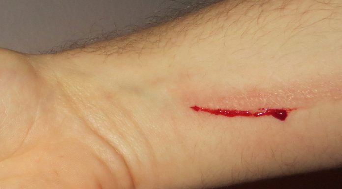 Interpretare vis în care apare o sânge/ sângerare Interpretare vis in care apare o sange sangerare