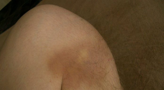 Interpretare vis in care apare o vanataie