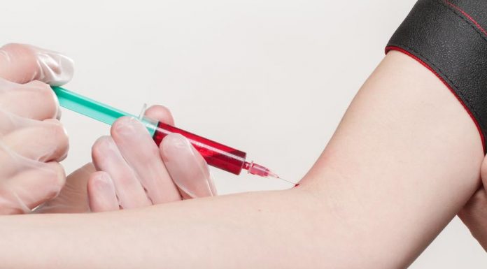 Interpretare vis in care apare o vena