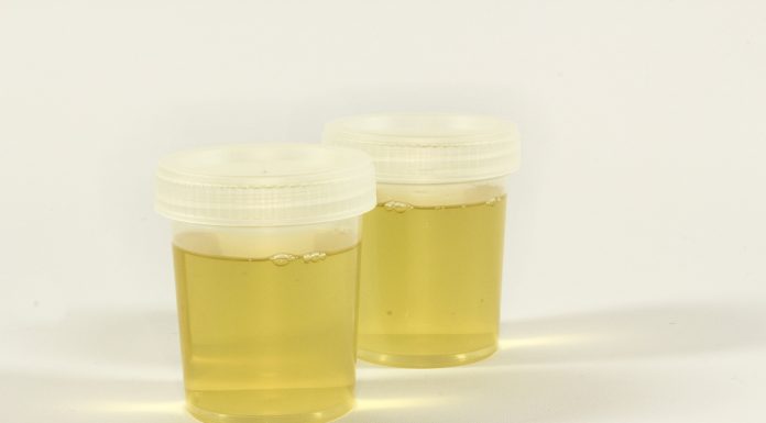 Interpretare vis in care apare pisat urina