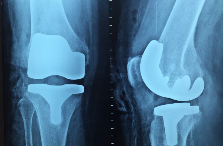 Interpretare vis in care apare radiografie