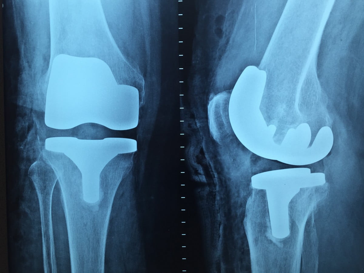 Interpretare vis in care apare radiografie