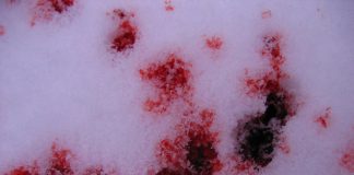 Interpretare vis în care apare sânge Interpretare vis in care apare sange