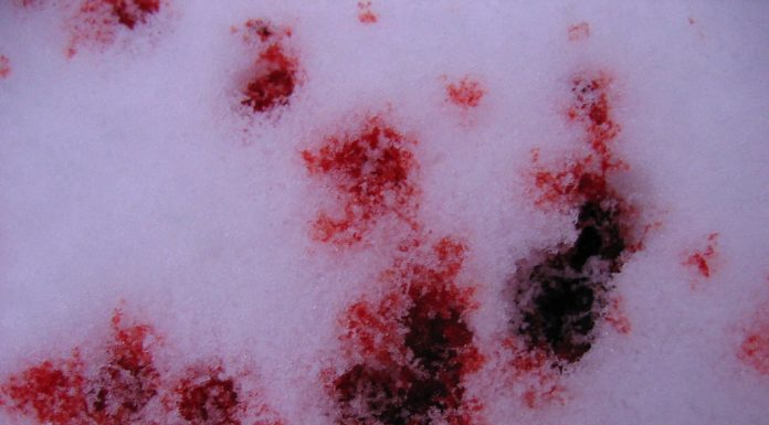 Interpretare vis în care apare sânge Interpretare vis in care apare sange