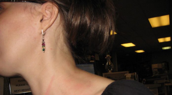 Interpretare vis in care apare un gat