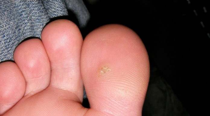 Interpretare vis in care apare un neg