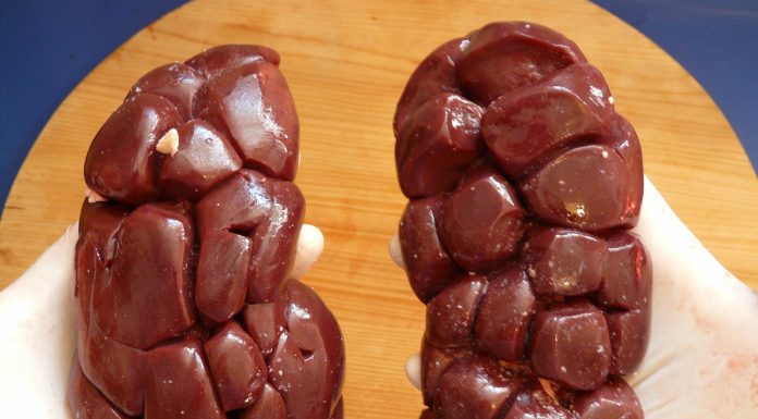 Interpretare vis în care apare un rinichi Interpretare vis in care apare un rinichi