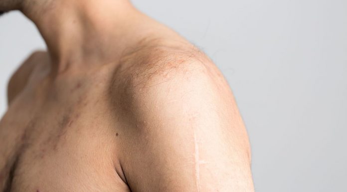 Interpretare vis în care apare un umăr Interpretare vis in care apare un umar