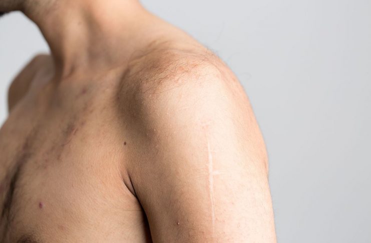 Interpretare vis in care apare un umar