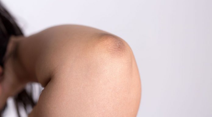 Interpretarea vis în care apare un cot Interpretarea vis in care apare un cot