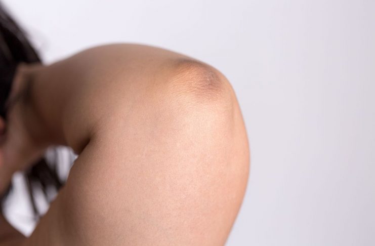 Interpretarea vis in care apare un cot