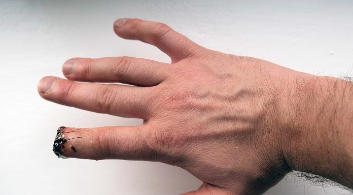 Interpretare vis in care ti se amputeaza un picior sau o mana