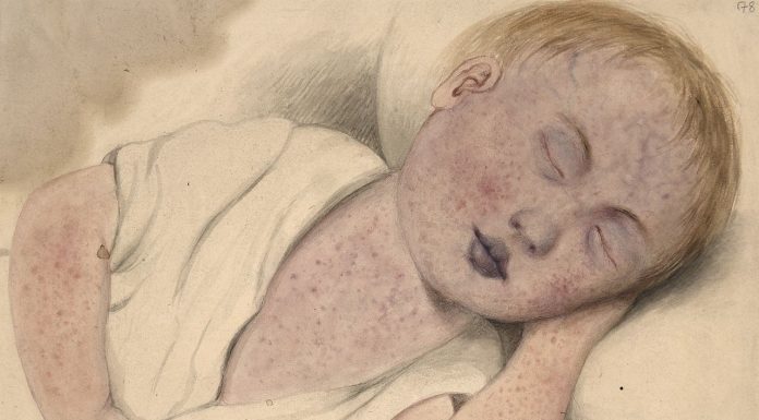 Interpretare vis in care copilul tau se naste cu malformatii