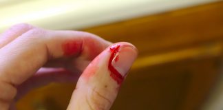 Interpretare vis în care îți rupi unghiile Interpretare vis in care iti rupi unghiile