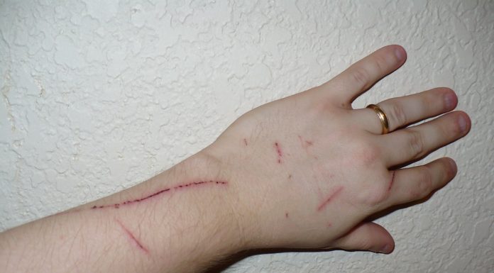 Interpretare vis in care te zgarie pisica