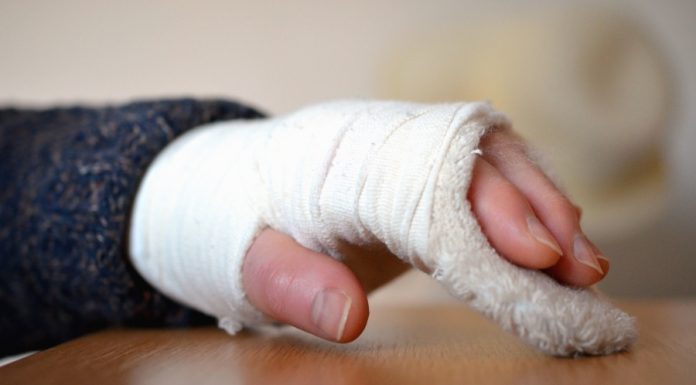 Interpretare vis in care iti rupi mana sau un picior